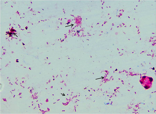 acid fast stain mycobacterium paratuberculosis in feces